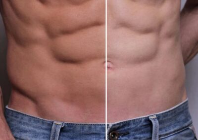 Spraytan3